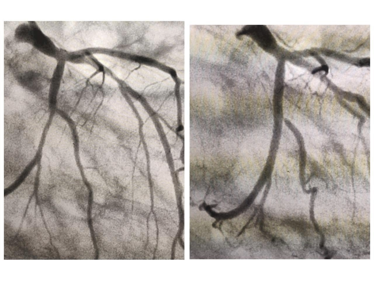 XIENCE Sierra Image 3